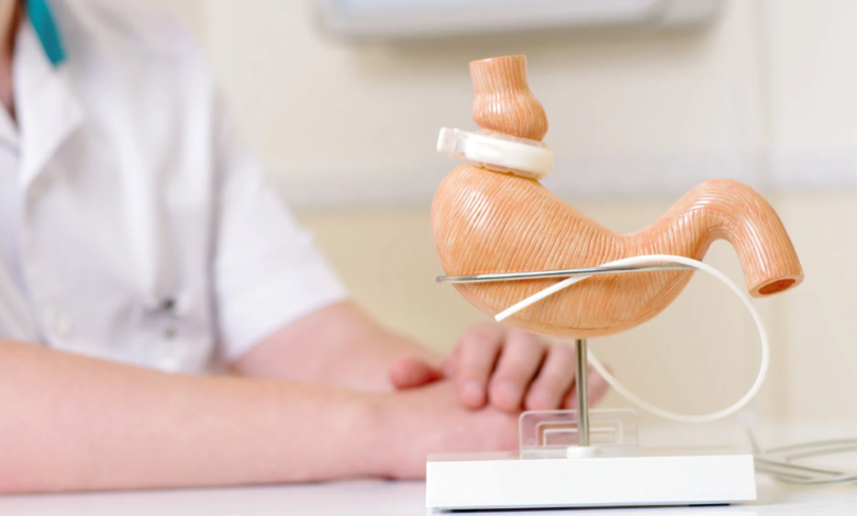 Lap Band Surgery and Its Impact on Obesity-Related Health Conditions