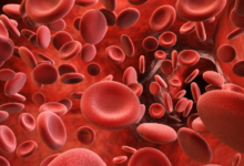 The Role of TruDOSE Regenerative Technology in Managing Systemic Inflammation