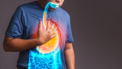 The Essential Steps for Managing Chronic GERD Symptoms Effectively